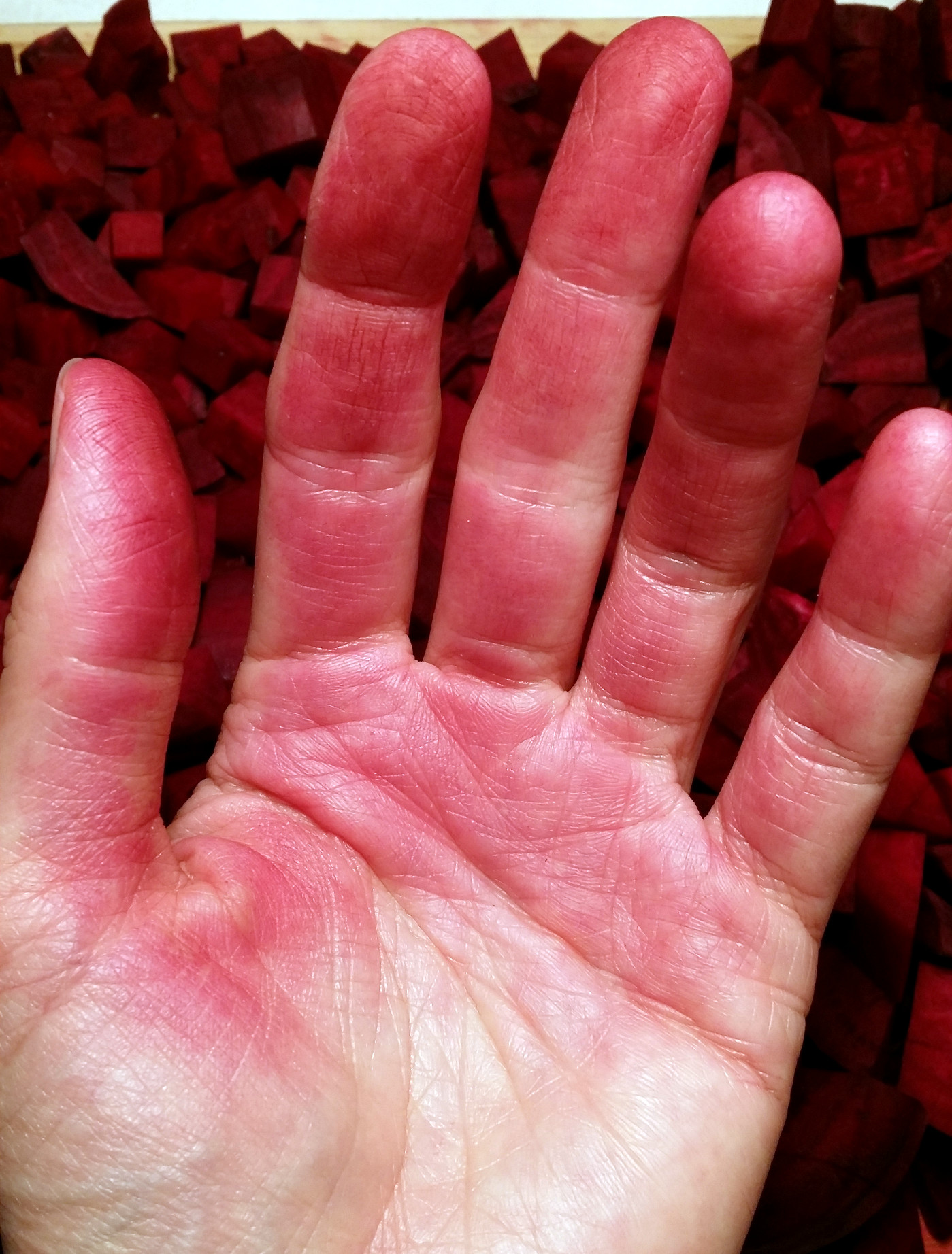 stained beet hands